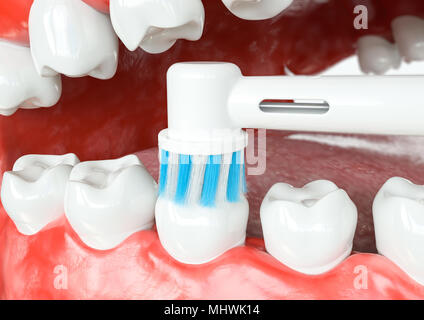 Zahnreinigung okklusalen Oberflächen - 3D-Rendering Stockfoto