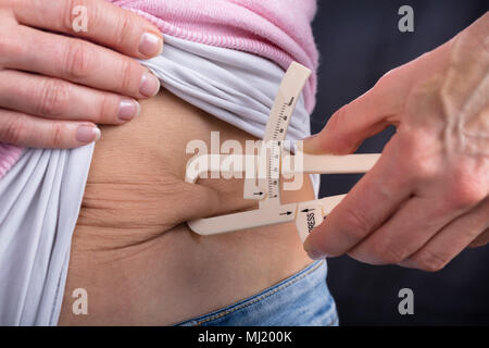 Nahaufnahme von einer Frau Hand messen Bauch Fett mit Bremssattel Stockfoto