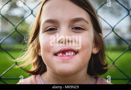 Portrait von Zahnlosen kind Mädchen fehlt Milch- und bleibenden Zähne. Nahaufnahme des junges Zicklein mit Zähnen Lücken und wachsenden bleibenden Zähne und gesundes Zahnfleisch p Stockfoto