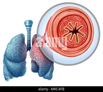 COPD chronisch obstruktive Lungenerkrankung als medizinisches Konzept für Lungenkrebs Krankheit und Emphysem mit 3D-Illustration Elemente. Stockfoto