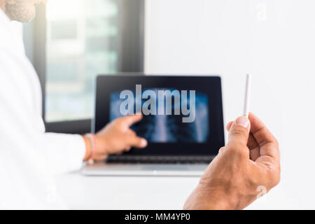 Arzt erklären, Lunge Röntgen auf dem Bildschirm Patient Stockfoto
