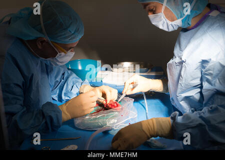 Nierentransplantation Stockfoto