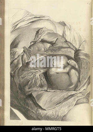 . Govard Bidloo, (1649-1713): Ontleding des menschelyken lichaams Amsterdam, 1690. (= niederländische Sprache Edition von Anatomia Humani Corporis, 1685). Gerard de Lairesse (Zeichnungen), Abraham Blooteling, Pieter Stevens van Gunst (GRAVEURE)/Scans von NLM Bidloo Ontleding 1690 56 Stockfoto