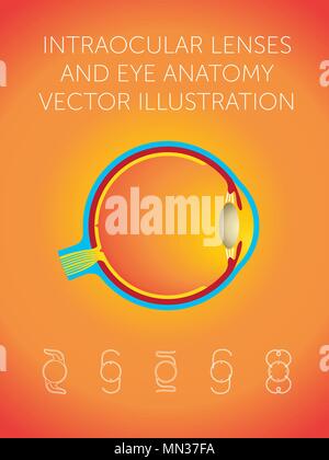 Schematische Darstellung der Struktur des Auges und Arten von Intraokularlinsen auf orange Hintergrund Stock Vektor
