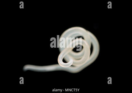 Eine parasitäre Nematoden oder rundwürmer, das von der Oberfläche eines Pollack Leber England UK entfernt wurde Stockfoto