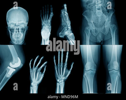 Sammlung hochwertiger x-ray Bild und Körper Teil Stockfoto