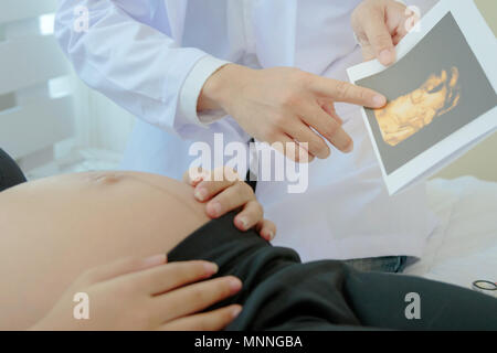 Schwangere Frau liegt im Bett, während Arzt zeigt das Ultraschallbild. Stockfoto