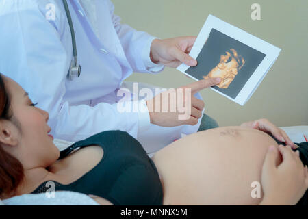 Schwangere Frau liegt im Bett, während Arzt zeigt das Ultraschallbild. Stockfoto