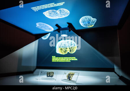 22. Mai 2018, Deutschland, Münster: zwei Glasplatten mit einem mikroskopischen Abschnitt des Hirngewebes von Albert Einstein sind in einem glas Vitrine an der Westfälischen Museum für Naturkunde angezeigt. Die Sonderausstellung "Das Gehirn - Intelligenz, Bewusstsein, Gefühl' zeigt besondere Exemplare, unter Ihnen, Teile von Albert Einsteins Gehirn. Es öffnet am 29. Juni an der Westfälischen Museum für Naturkunde. Foto: Guido Kirchner/dpa Stockfoto
