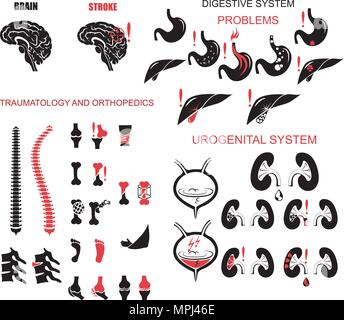 Orthopädie, Nephrologie und Gastroenterologie. Abbildung in Norm und Pathologie. Stock Vektor