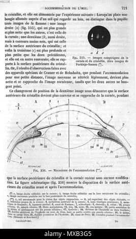 . Français: Abb. 335. Bilder catoptrique de la cornée et du cristallin, dites-des-Bilder de Purkinje-Sanson/Abb. 336. Mécanisme de l'Unterkunft - "Traité des maladies des Yeux 19e siècle Auteur de l'ouvrage: Galezowski, Xavier Ouvrage: "Traité des maladies des yeux Ausgabe: Paris: J.B. Baillière et Fils, 1870. 4. Mai 2015. Ouvrage Galezowski, Xavier: "Traité des maladies des yeux Ausgabe: Paris: J.B. Baillière et Fils, 1870 295 Bilder de Purkinje-Sanson Stockfoto