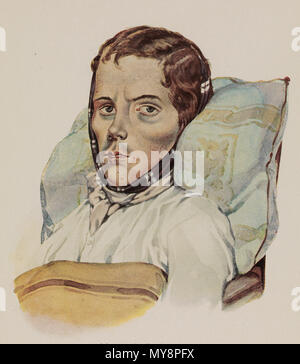 L 0074300 Menschen leiden an Lungentuberkulose, Baumgartner, 292 Karl Sandhaas Karl Heinrich Baumgärtner Schwindsüchtiger Stockfoto