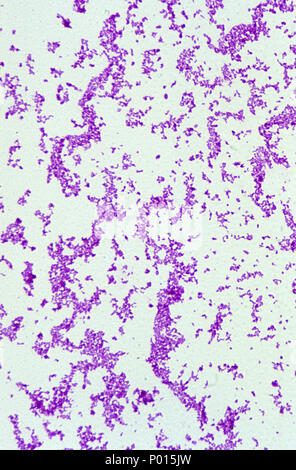 Corynebacterium Diphtheriae Bakterien Stockfoto