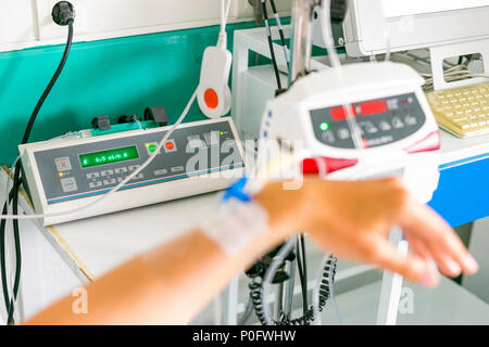 Hand mit peripheren venösen Katheter und Ausrüstung zu Dosis epiduraler während der Lieferung Stockfoto