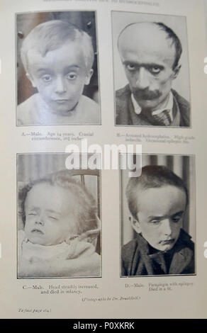 'MENTALE MANGEL" (Amentia), fünfte Auflage, 1929... IMG 3569 bearbeitet-22. Stockfoto