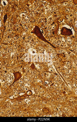 Multipolare Neuron der spinalen Cordon. Nervengewebe 140x Stockfoto