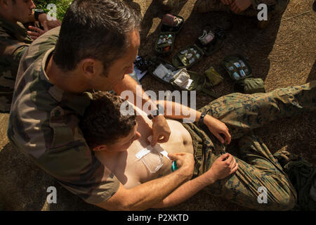 Französische Armee WO2 Florent Pourtier, einem medizinischen Assistenten mit 3 Infanterie Regiment, zeigt, wie eine Wunde in der Brust im Camp Broche, Neukaledonien, August 8, 2016 während der Übung AmeriCal 16 zu behandeln. AmeriCal ist ein bilaterales Training konzipiert, Interoperabilität, gegenseitige Bekämpfung Fähigkeiten zu verbessern und die Beziehungen mit unseren Partnern zu verbessern. (U.S. Marine Corps Foto von Cpl. Carlos Cruz jr./Freigegeben) Stockfoto