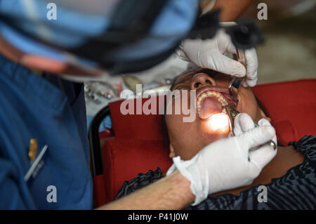 LA BLANCA, Guatemala - US Air Force Maj. Nicholas Duvall, 81St zahnmedizinische Squadron Zahnarzt, extrahiert einen Zahn von esmerelda Carrillo, La Blanca Bewohner, an einer medizinischen Readiness Training übung Juni 2, 2016, während der Übung über den Horizont 2016 GUATEMALA. Duvall entfernt Carrillos Zahn Schmerzen und Schäden an den umliegenden Zähne verhindern. (U.S. Air Force Foto von älteren Flieger Dillon Davis/Freigegeben) Stockfoto