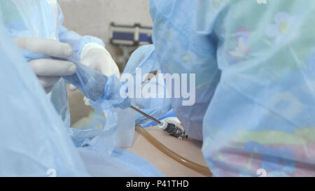 Chirurgen befolgen Sie die laparoskopische Chirurgie Stockfoto