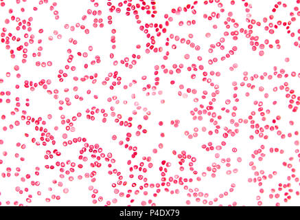 Menschliche Blutzellen unter dem Mikroskop. Hohe vergrößerte Abstrich von roten Blutkörperchen im Blut. Körperflüssigkeit in den Menschen. Körper Anatomie. Close Up. Stockfoto