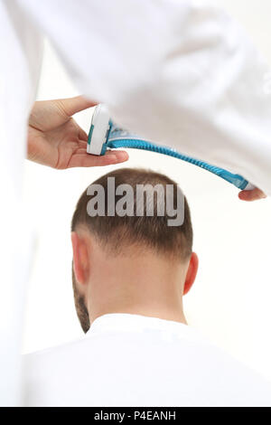 Laserbestrahlung der Kopfhaut. Pflege Behandlung für die Stärkung der Haarzwiebeln . Dermatologe. Behandlung gegen Haarausfall. Haarausfall bei Männern. Stockfoto