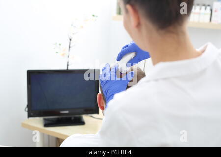 Trichologische Untersuchung. Mikroskopische Analyse des Zustands von Haar und Kopfhaut. Der Kopf eines Mannes mit dünner werdendem Haar während der Untersuchung Stockfoto