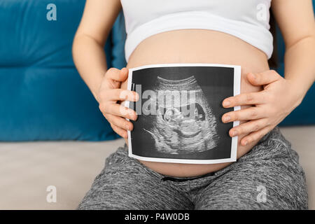 Schwangere Frau mit Ultraschall Stockfoto
