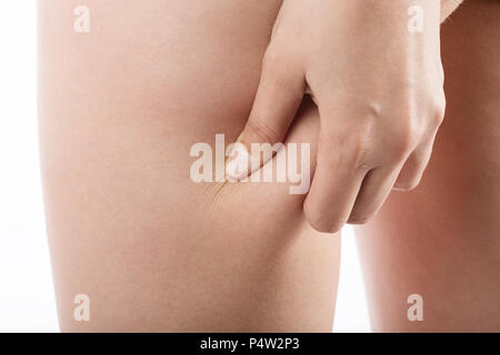 Punch weibliche Hüften mit Cellulite auf weißem Hintergrund Stockfoto