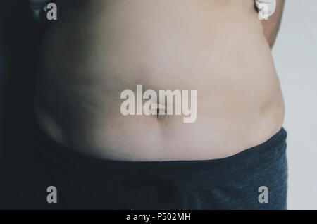 Nahaufnahme des menschlichen Körpers und fetten Körper, Fett Körper Teil der Bauch oder Bauch, Übergewicht von Personen oder Übergewicht. Stockfoto