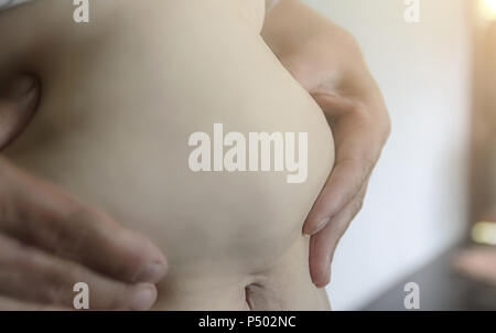 Nahaufnahme des menschlichen Körpers und fetten Körper, Fett Körper Teil der Bauch oder Bauch, Übergewicht von Personen oder Übergewicht. Stockfoto