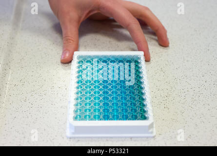Die Arbeit im Labor: Proben in eine 96-Well-PCR-Platten innerhalb der ELISA-Diagnose Stockfoto