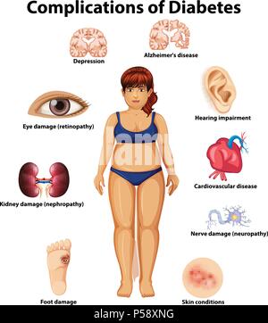 Ein Komplikationen von Diabetes Abbildung Stock Vektor