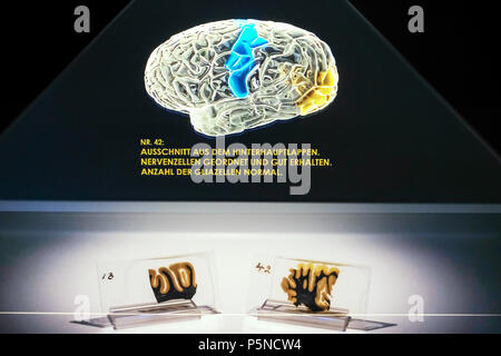 Zwei histologischen Schnitten aus dem Gehirn von Albert Einstein (1879-1955) unten und ein dreidimensionales Hologramm seines Gehirns in der Ausstellung "Das Gehirn - Intelligenz, Bewusstsein, Gefühl" im LWL-Museum für Naturkunde, Münster, Deutschland, Jujy 2018 (Lender: Mütter Museum, philadelphie) Stockfoto