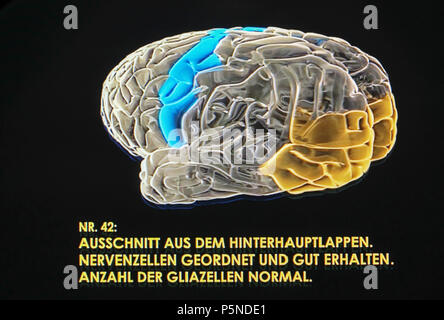 Ein dreidimensionales Hologramm des Gehirns von Albert Einstein (1879-1955) ist in der Ausstellung "Das Gehirn - Intelligenz, Bewusstsein, Gefühl" im LWL-Museum für Naturkunde, Münster, Deutschland, Jujy 2018 (Lender: Muetter Museum, philadelphie) Stockfoto