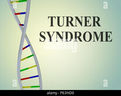 3D-Darstellung der Turner Syndrom Skript mit der Doppelhelix, auf farbigem Hintergrund. Stockfoto