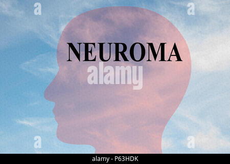 Render Abbildung: NEUROM Titel auf dem Kopf silhouette, mit bewölktem Himmel als Hintergrund. Stockfoto