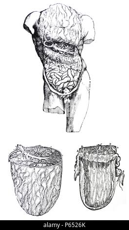 Die Platten aus dem Fünften Buch des De Humani Corporis Fabrica von Andreas Vesalius (1514-1564) Platte 54 - Die dritte Figur der Zweiten in der Reihenfolge der Verwaltung folgt und zeigt die untere Membran des Omentum zerrissen und zog sich von der oberen vorderen Schichten. Stockfoto
