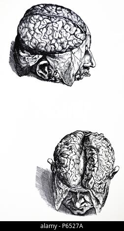 Die Platten aus dem 7. Buch der De Humani Corporis Fabrica von Andreas Vesalius (1514-1564) Platte 67 - Die zweite Abbildung der ersten in der Reihenfolge der Zerlegung und zeigt die dritte Sinus der dural Membran mit einem langen Schnitt in der Länge des Kopfes durchgeführt öffnen, gehen Sie folgendermaßen vor. Stockfoto