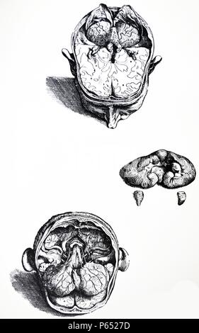 Die Platten aus dem 7. Buch der De Humani Corporis Fabrica von Andreas Vesalius (1514-1564) Platte 70 - Der achte Figur aus der 7. In dieser Hinsicht unterscheidet, dass wir hier Resezierten haben noch mehr des Gehirns und die Hoden des Gehirns durch einen langen Schnitt unterteilt, so dass der Durchgang vom dritten in den vierten Ventrikel aufgetreten ist. Stockfoto