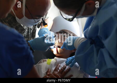 Us-Armee Maj. John ausstatten und Pfc. Courtney Madeforsex, mit der 185 Dental Gmbh, Extrakte Zahn eines Patienten während einer medizinischen Readiness Training übung in San Padro, Guatemala, 10. Mai 2016. Task Force Red Wolf und Armee nach Süden führt Humanitäre Zivile Hilfe Ausbildung auf taktischer Ebene Bauprojekte und medizinische Bereitschaft Übungen medizinische Zugang und den Bau von Schulen in Guatemala mit der guatemaltekischen Regierung und nicht-staatlichen Stellen von 05 Mär 16 bis 18 Apr 16 Um die Mission die Bereitschaft der US-Streitkräfte zu verbessern und einen nachhaltigen Nutzen zu liefern. Stockfoto