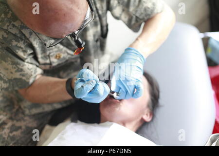 Us-Armee Maj. John zu verleihen, mit dem 185 Dental Gmbh, Extrakte Zahn eines Patienten während einer medizinischen Readiness Training übung in San Padro, Guatemala, 10. Mai 2016. Task Force Red Wolf und Armee nach Süden führt Humanitäre Zivile Hilfe Ausbildung taktischer Ebene Bauprojekte und medizinische Bereitschaft Übungen medizinische Zugang und den Bau von Schulen in Guatemala mit der guatemaltekischen Regierung und nicht-staatlichen Stellen von 05 Mär 16 bis 18 Apr 16 Um die Mission die Bereitschaft der US-Streitkräfte zu verbessern und einen nachhaltigen Nutzen für die Menschen in Guatemala zur Verfügung zu stellen. ( Stockfoto