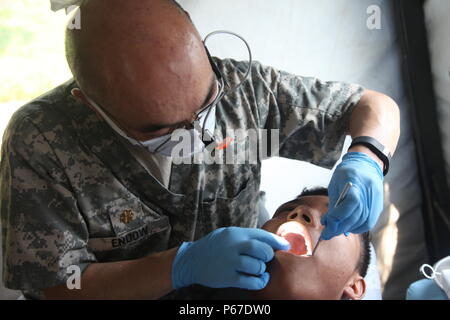 Us-Armee Maj. John verleihen mit dem 185 zahnmedizinische Gesellschaft bewertet einen Patienten Zähne und Kontrollen für die Hohlräume während einer medizinischen Bereitschaft Übung in San Padro, Guatemala, 10. Mai 2016. Task Force Red Wolf und Armee nach Süden führt Humanitäre Zivile Hilfe Ausbildung taktischer Ebene Bauprojekte und medizinische Bereitschaft Übungen medizinische Zugang und den Bau von Schulen in Guatemala mit der guatemaltekischen Regierung und nicht-staatlichen Stellen von 05 Mär 16 bis 18 Apr 16 Um die Mission die Bereitschaft der US-Streitkräfte zu verbessern und einen nachhaltigen Nutzen für die Menschen zu gehören Stockfoto