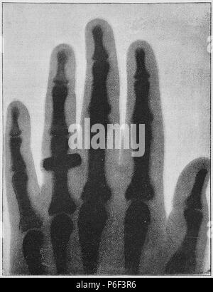 . Gartenlaube sterben. Ausdruck Fehler: nicht erkanntes Wort 'die'. English: Bildunterschrift: "Eine Damenhand. / Dm Röntgenschen Verfahren aufgenommen von S. Spione in Berlin 1896. (Vergl. den Artikel S.75.) " Deutsch: Bildunterschrift: "Eine Damenhand. / Dm Röntgenschen Verfahren aufgenommen von S. Spione in Berlin 1896. (Vergl. den Artikel S. 75).". N/A 28 Gartenlaube (1896) b 0084 sterben Stockfoto