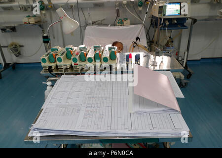 Tam Duc Kardiologie Krankenhaus. Vietnamesische Kind leiden von Herzkrankheiten. Intensivstation. Ho Chi Minh City. Vietnam. Stockfoto