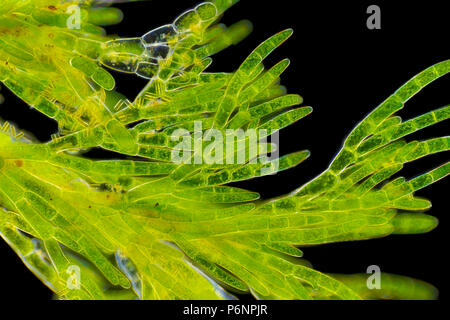 Mikroskopische Ansicht von grünen Algen (cladophora). Sichtbar auch Kieselalgen Zellen. Darkfield Ablichtung. Stockfoto