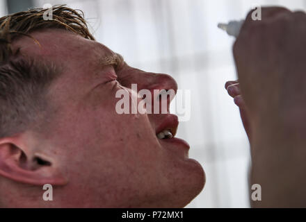 Lance Cpl. Travis Bodjanac Augentropfen verwendet, nachdem ein Teil des U.S. Marine Corps Kämpfer Taucher Kurs auf Lager Schwab, Okinawa, Japan, 11. Mai 2017. Nach dem Tauchen die Schüler sitzen für 10 Minuten, um sicherzustellen, dass Sie sich nicht der Gefahr von potentiellen Gefahren mit dem Druck unter Wasser. Das USMC Kämpfer Taucher Kurs ist acht Wochen und kombiniert Vorträge, Demonstrationen und praktische Anwendung der Stromkreis tauchen, tauchen Physik und medizinische Hilfe. Bodjanac, von Stow, Ohio, ist eine Aufklärung Marine mit 3 Reconnaissance Bataillon, 3rd Marine Division, III Marine Expeditionary Force. Stockfoto