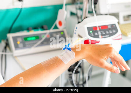 Hand mit peripheren venösen Katheter und Ausrüstung zu Dosis epiduraler während der Lieferung Stockfoto