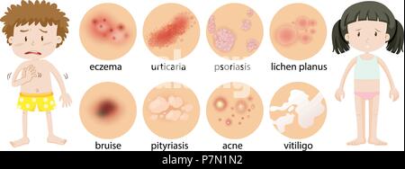 Junge Kinder mit verschiedenen Hauterkrankungen Abbildung Stock Vektor