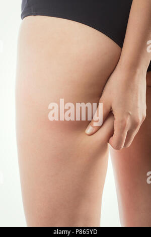 Punch weibliche Hüften mit Cellulite auf weißem Hintergrund Stockfoto