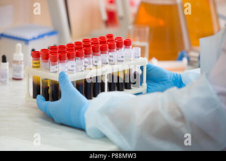 Blutprobe. Blut in Reagenzgläsern Stockfoto